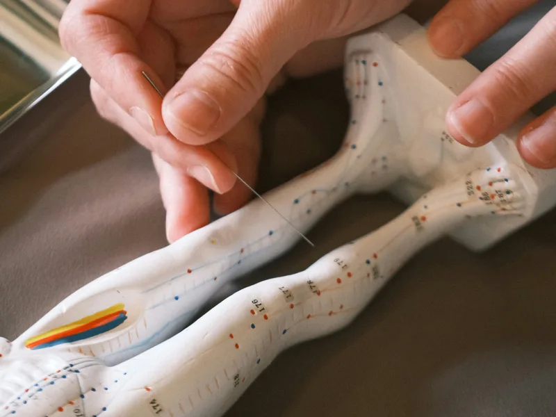 Acupuncture at Aligned Medical Group in Malvern