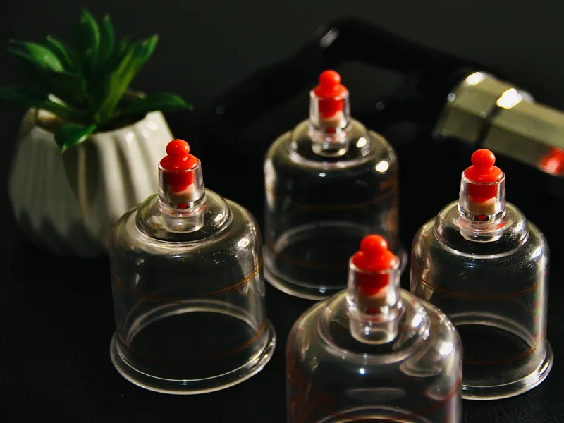 How Cupping Therapy works at Aligned Medical Group