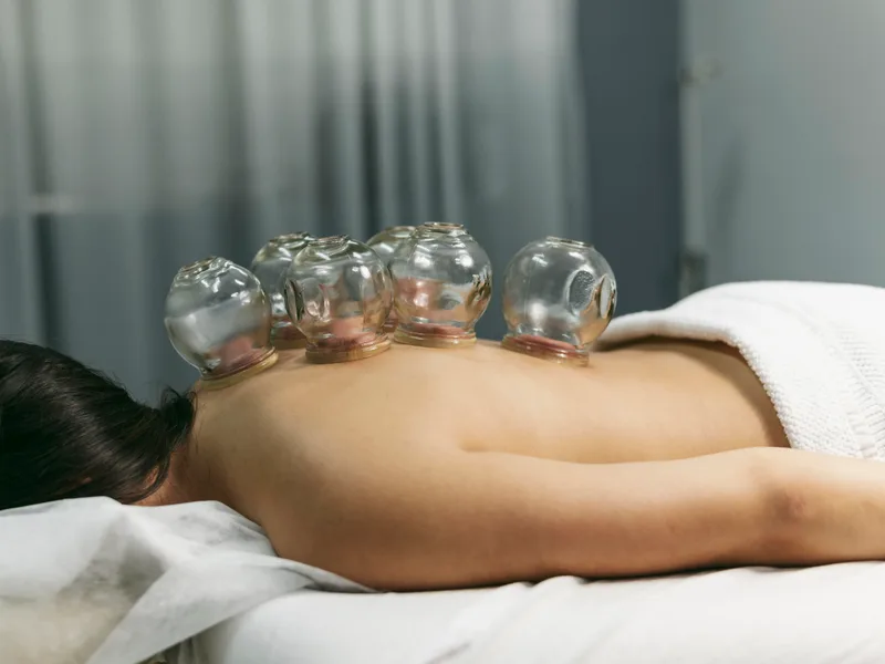 Cupping Therapy at Aligned Medical Group in Malvern